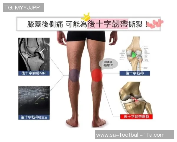 打完篮球后膝盖疼痛的原因及预防措施解析